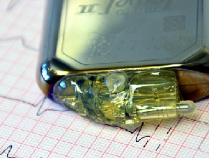 pacemaker-1943662_640