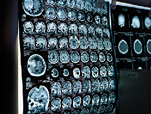 x-ray-6841384_640